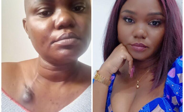 Arcy Leckouta : un témoignage de résilience face au cancer du sein